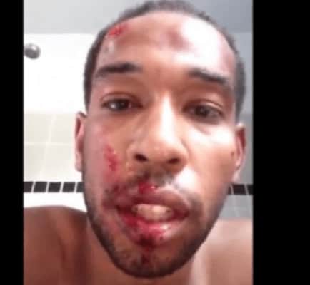 Ohio Man Posts Emotional Video After He Is Badly Beaten Trying to Help His Community