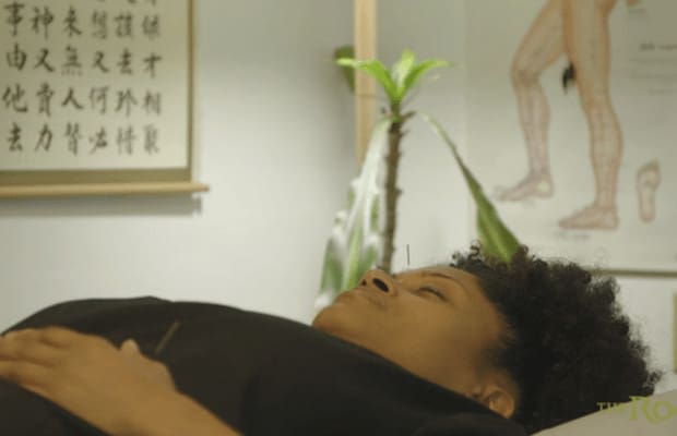 ACUPUNCTURE: TAP INTO YOUR QI