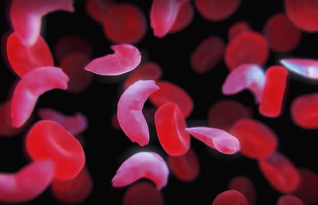 How Black Communities Could Better Help Sickle Cell Patients